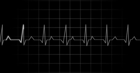 EKG Heartbeat reading animation on black background. Medical monitor displaying cardiography pulse checkup diagnosis electronic screen display machine. Cardiogram nubes rate ecg waveform surgery.