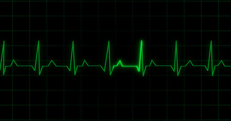 EKG Heartbeat reading animation on black background. Medical monitor displaying cardiography pulse checkup diagnosis electronic screen display machine. Cardiogram nubes rate ecg waveform surgery.