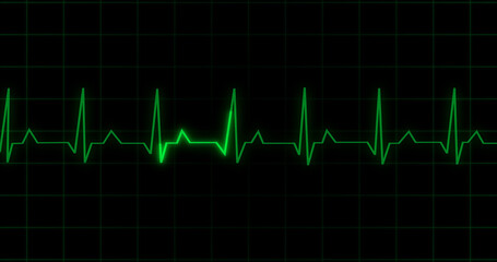 EKG Heartbeat reading animation on black background. Medical monitor displaying cardiography pulse checkup diagnosis electronic screen display machine. Cardiogram nubes rate ecg waveform surgery.