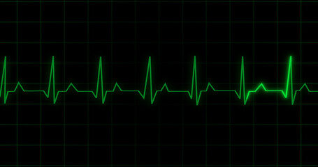 Naklejka premium EKG Heartbeat reading animation on black background. Medical monitor displaying cardiography pulse checkup diagnosis electronic screen display machine. Cardiogram nubes rate ecg waveform surgery.