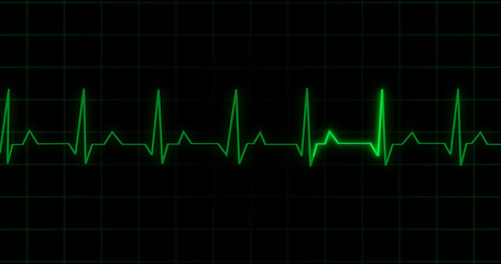 EKG Heartbeat reading animation on black background. Medical monitor displaying cardiography pulse checkup diagnosis electronic screen display machine. Cardiogram nubes rate ecg waveform surgery.