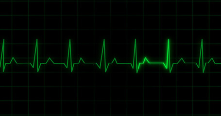 EKG Heartbeat reading animation on black background. Medical monitor displaying cardiography pulse checkup diagnosis electronic screen display machine. Cardiogram nubes rate ecg waveform surgery.