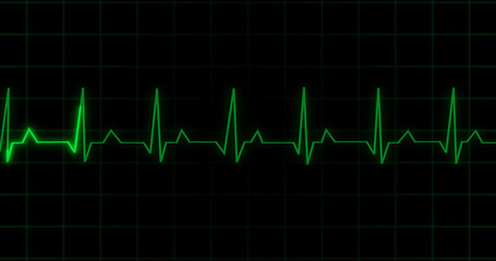EKG Heartbeat reading animation on black background. Medical monitor displaying cardiography pulse checkup diagnosis electronic screen display machine. Cardiogram nubes rate ecg waveform surgery.
