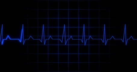 EKG Heartbeat reading animation on black background. Medical monitor displaying cardiography pulse checkup diagnosis electronic screen display machine. Cardiogram nubes rate ecg waveform surgery.