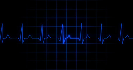 EKG Heartbeat reading animation on black background. Medical monitor displaying cardiography pulse checkup diagnosis electronic screen display machine. Cardiogram nubes rate ecg waveform surgery.