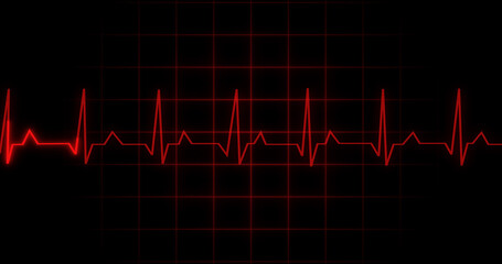 EKG Heartbeat reading animation on black background. Medical monitor displaying cardiography pulse checkup diagnosis electronic screen display machine. Cardiogram nubes rate ecg waveform surgery.