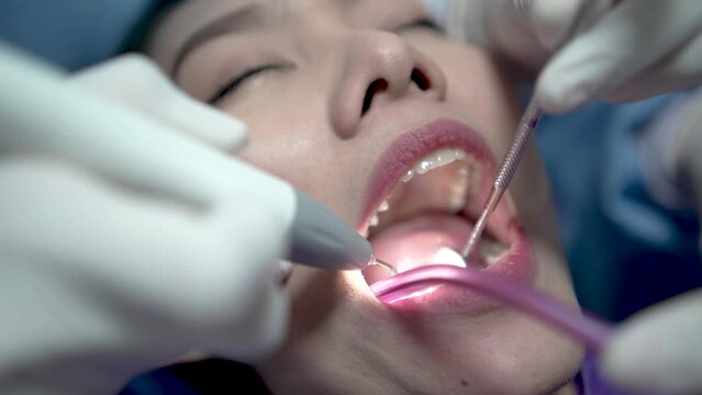 Close up woman getting a dental treatment, Doctor probing teeth with dental instrument using an explorer look for cavities treatment.