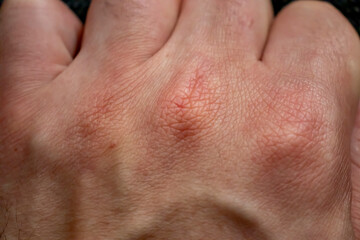 Close-up human hand with vein. Details of skin. Male hand texture