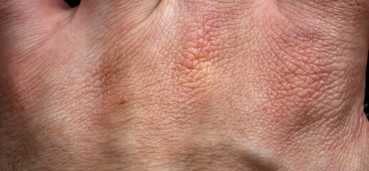 Fototapeta premium Human hand. Male skin pattern. Dermatology background. Health skin.