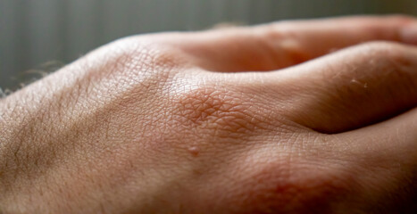 Human hand. Male skin pattern. Dermatology background. Health skin.