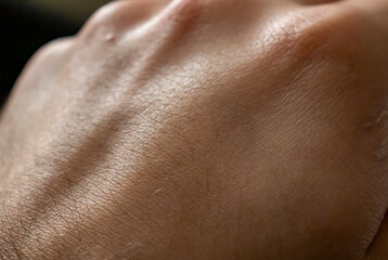 Naklejka premium Human hand. Male skin pattern. Dermatology background. Health skin.