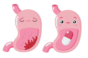 Cartoon stomach. Stomach tumor. Pills and medicines.Healthy and sick stomach character. Gastritis heartburn. Improper diet, acid, infection. Stock vector illustration isolated on white background.
