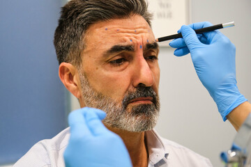 A man is getting ready to get Botox for forehead wrinkles by a aesthetic doctor in a clinic.