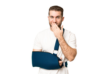 Young handsome blonde man with broken arm and wearing a sling over isolated chroma key background...