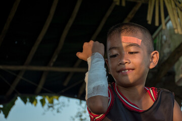 Plastic bandage on head and arm bandage wound Asian young boy cute smile and charming on indoor blur background, concept of children accidents and first aid,children with band-aid,happy accident.