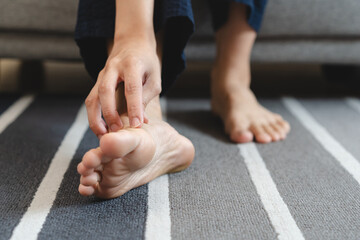 Close-up bare feet of person feeling itchy and irritated try to scratching by finger.