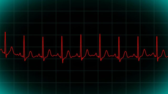 Cardiogram of the heart on the monitor. ECG diagnostics. Red heart rate scale. Animation. Looping, endless.