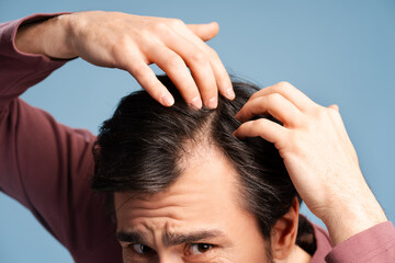 Close up of man examining his head on light blue background. Health care, medicine concept