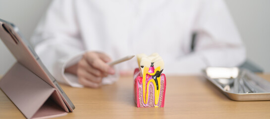 Dentist with tooth Anatomy model. Oral Teeth decay and disease, Scrape off tartar. March Oral...