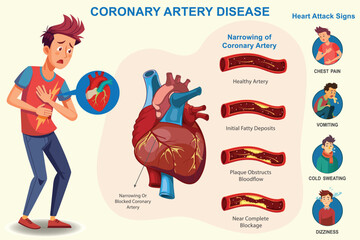 Coronary artery disease which Narrowing of heart arteries, restricting blood flow, leading to heart attacks and chest pain, Which increases risk of heart attack. 