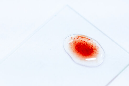 Blood group and rh factor testing by Doctor and Make a permanent slide In the Laboratory. 