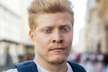 Close-up of albino latino man in the city street.