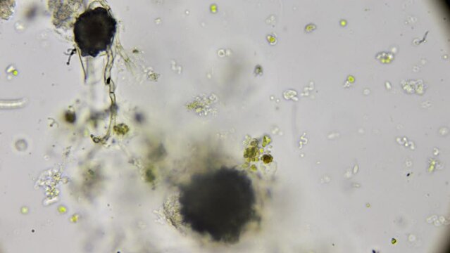 Explore the bustling microcosm within a water droplet, as tiny organisms like paramecia and spirulina swim under microscopic observation.