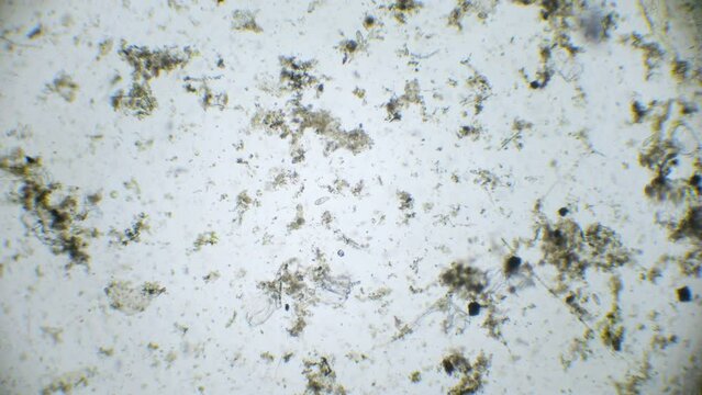 A microscopic lens captures the lively dance of paramecia and spirulina within a water droplet, illustrating the diversity of aquatic micro-life.