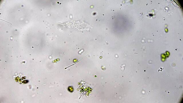 Discover the rich microbial life in a water droplet, where organisms like paramecia and spirulina are magnified for detailed observation.