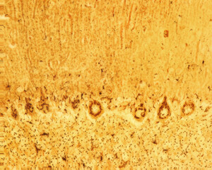 Cerebellum. Purkinje neurons. Golgi apparatus