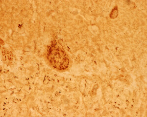 Cerebellum. Purkinje neurons. Golgi apparatus