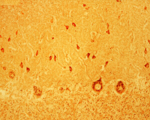 Cerebellum. Purkinje neurons. Golgi apparatus