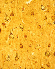 Cerebral cortex. Pyramidal neurons. Golgi apparatus