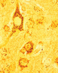 Cerebral cortex. Pyramidal neurons. Golgi apparatus