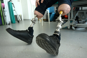 a man with bone-implanted leg prostheses. osteointegration