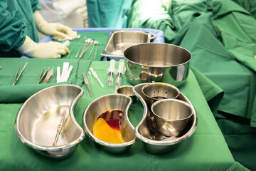 Disinfectant cup set for prepare breast surgery.Plastic surgeon sewing up breast of female patient...
