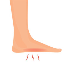 Foot pain suffering from cramp, numbness, muscular spasm