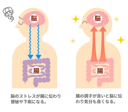 ストレスでお腹が痛くなる仕組み、脳と腸の関係。脳腸相関のイラスト。