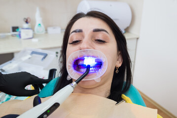 Restoration of teeth with filling-polymerization lamp.