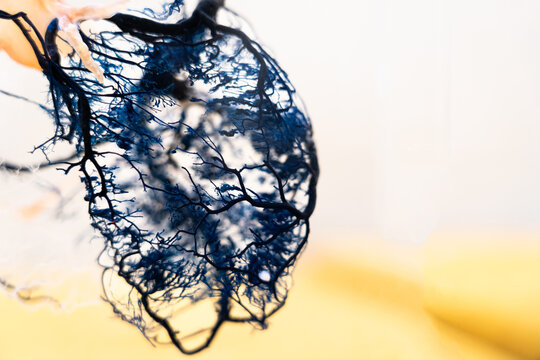 Capillary background, blood vessel, is a medical procedure used to visualize the circulatory system