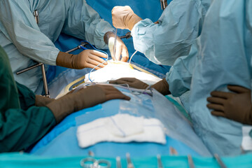 Sterile surgical instruments and tools including scalpels, scissors, forceps and tweezers arranged on a table for a surgery, Sterilized surgical instruments on the blue or green wrap	