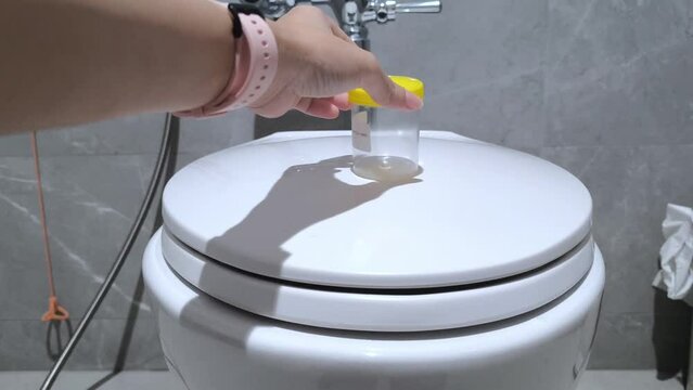 Hand picks up an empty container for testing urine onto the toilet bowl with the lid closed.For physical health examinations, kidney disease and various substances that can be detected from urine.