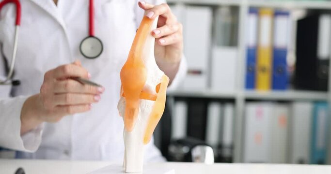 Doctor shows model of human artificial knee joint in medical office. Diseases of knee joints and ligaments
