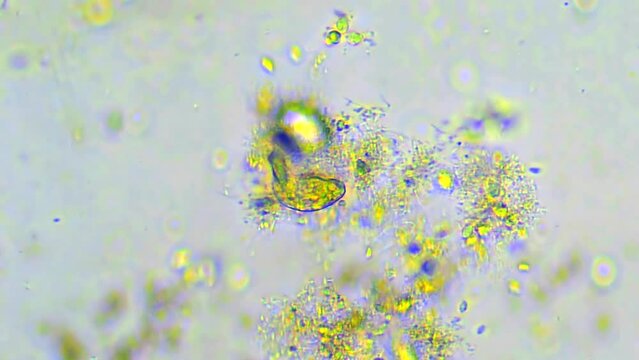Polymorph microorganism under microscope. Organisms Unicellular. Funny observation