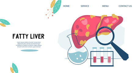 Non-alcoholic fatty liver disease or NAFLD web banner, flat vector illustration isolated on white background. Liver health checkup medical concept for website.