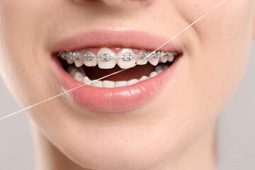 Smiling woman with braces cleaning teeth using dental floss on grey background, closeup