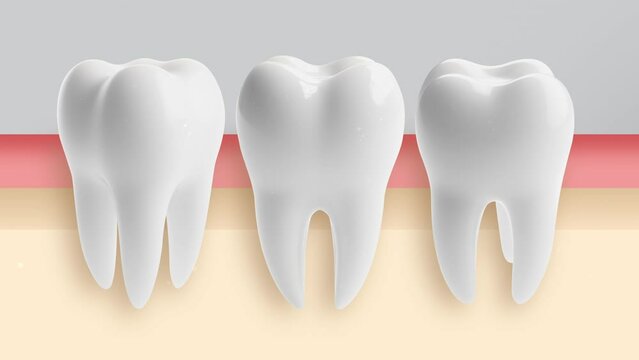 particle of fluoride or toothpaste ingredient turning yellow teeth to white.