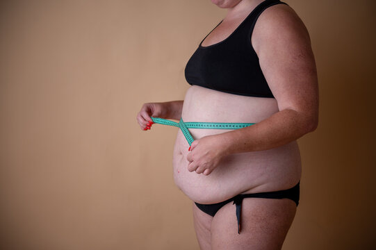 Plus size woman, touches belly with saggy skin, front view. Fat burning treatment for fat belly. Weight loss program, diet