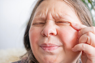 caucasian mature woman holding painful eye, peck of dust got into woman's eye, causing discomfort and irritation, Ocular health, Vision impairment