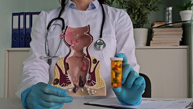 Doctor proctologist holding blisters with pills and anatomical model of rectum. Treatment of hemorrhoids and rectal fissures